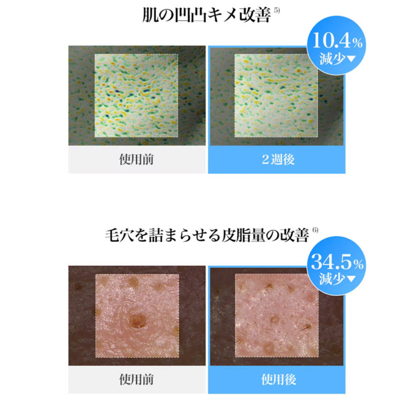 ブルーACカーミングトナーパッド