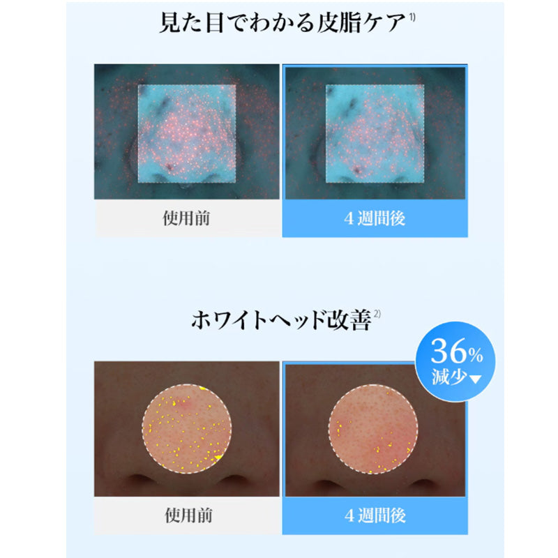 ブルーACカーミングセラム