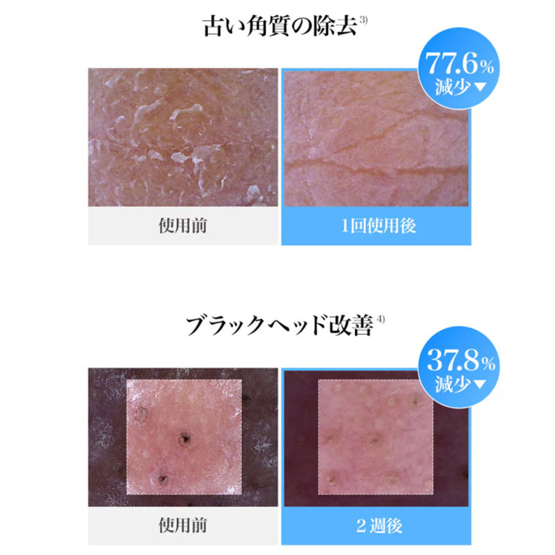 ブルーACカーミングトナーパッド