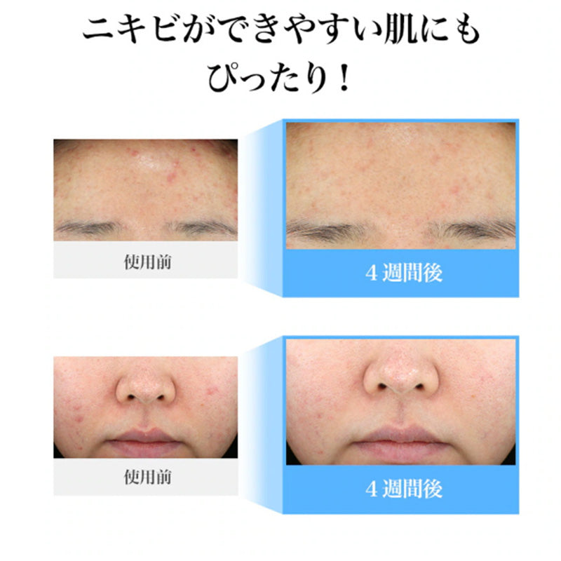 ブルーACカーミングセラム