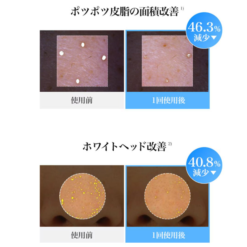 ブルーACカーミングトナーパッド