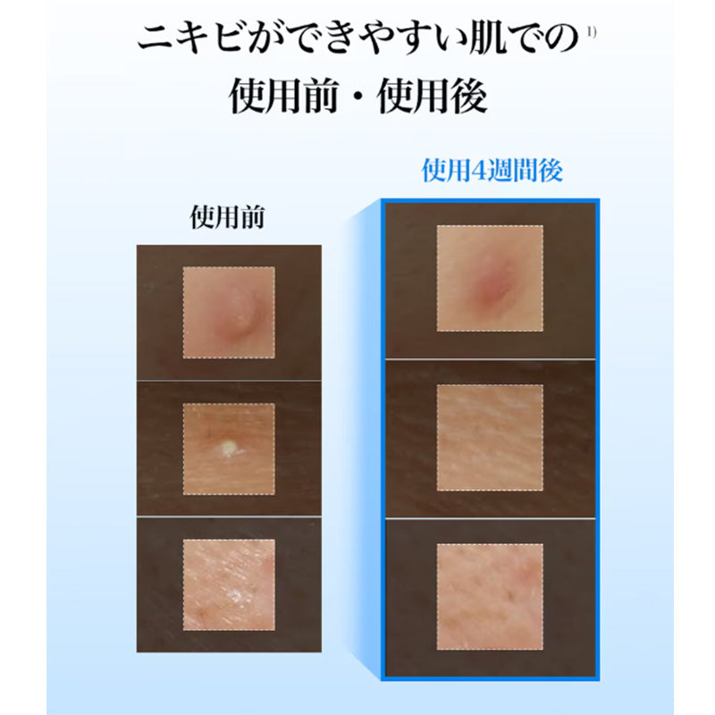 ブルーACカーミングトナーパッド