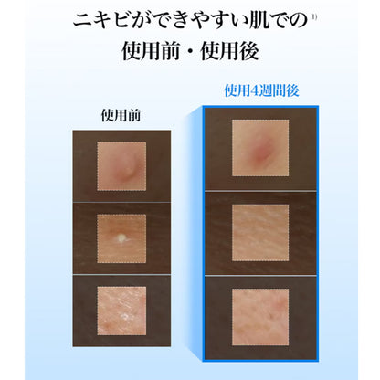 ブルーACカーミングトナーパッド