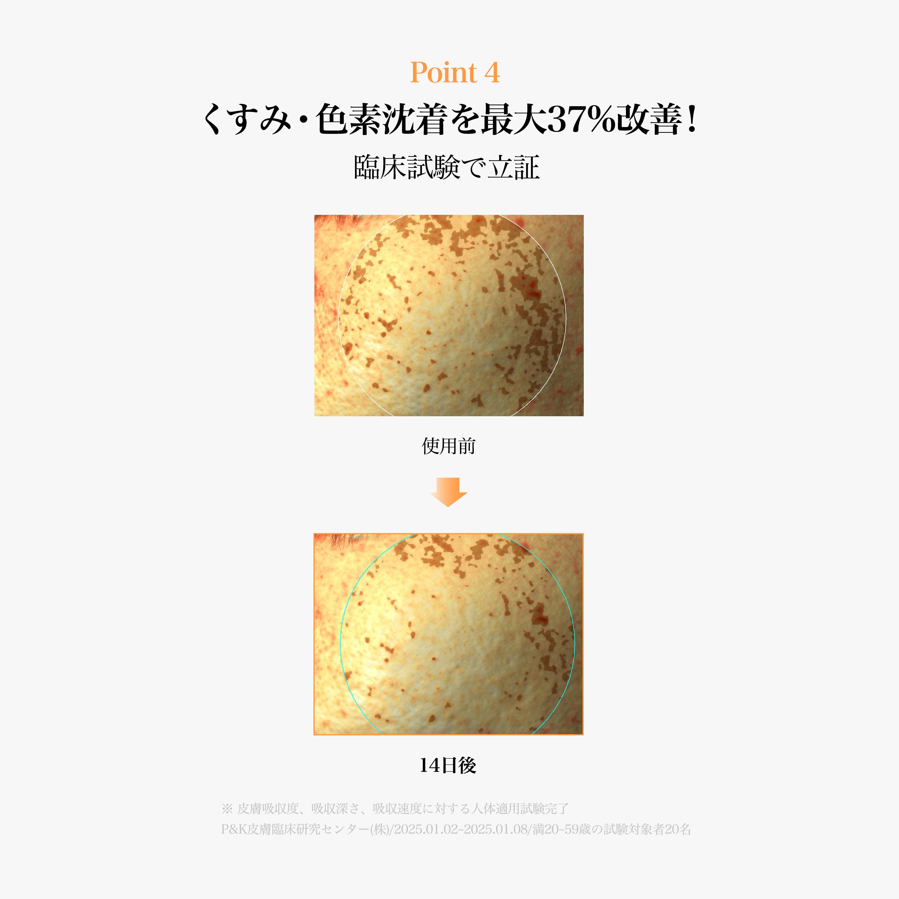 PDRN ビタグル カプセル化粧水