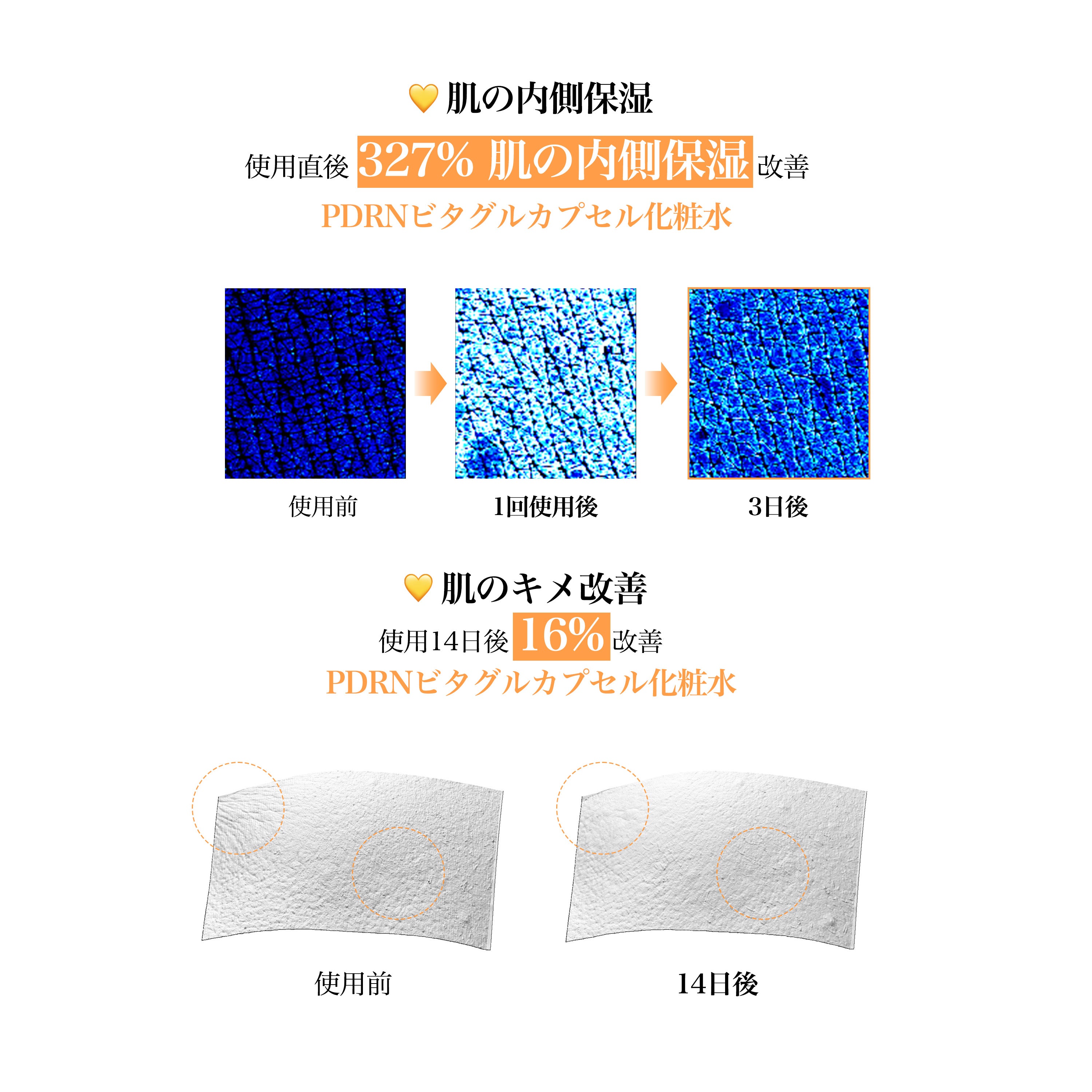 PDRN ビタグル カプセル化粧水