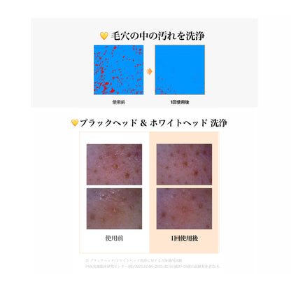 ヒアル ビタグル パッククレンザー